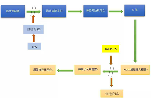 脑卒中形成机制 脑卒中形成机制