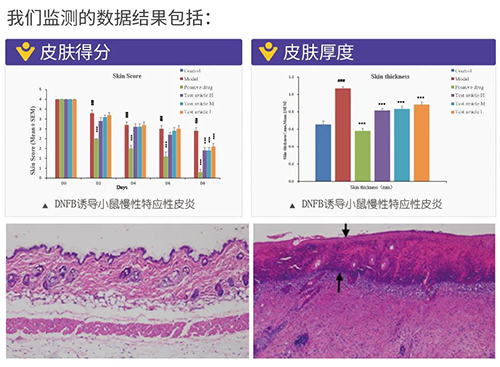 美迪西建立的特应性皮炎及湿疹模型监测数据结果